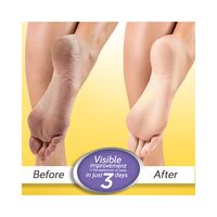 Krack Heel Repair Cream 15 gm